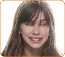 Piper before braces head shot