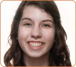 Eva after braces head shot