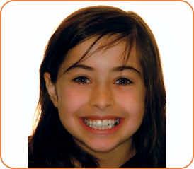 Frankie before braces head shot