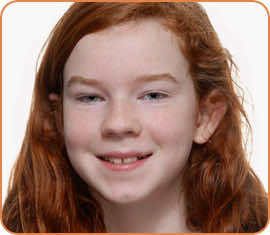 Olivia before braces head shot