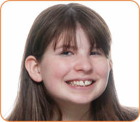 Luci before braces head shot